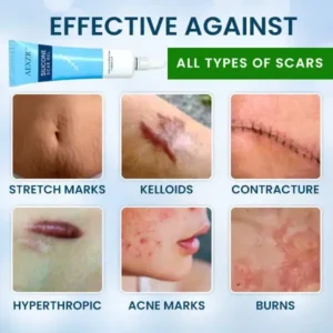 AEXZR™ Silicone Scar Gel