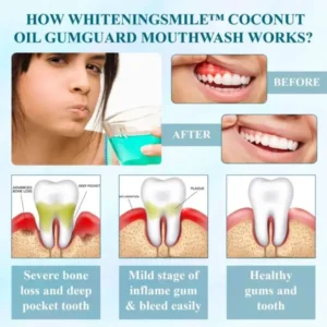 WhiteningSmile™ Coconut Oil GumGuard Mouthwash