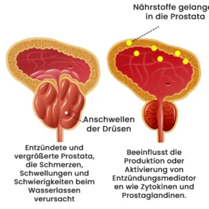 AEXZR™ Detox Prostata-Pflaster