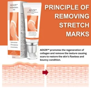 AEXZR™ Stretchmarks Removal Cream