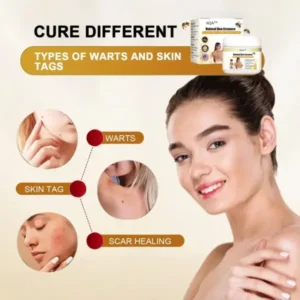 AQA™ Natural Bee Essence Mole and Wart Treatment Cream