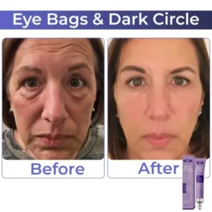 AQA™ Retinol Cream for Dark Circles & Wrinkles