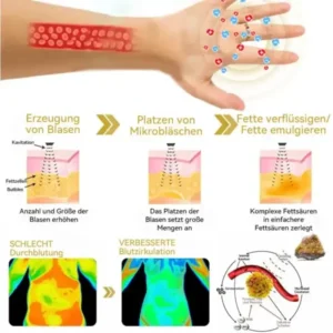 CZTICLE™ Mikro-Nano-Fusionsdiamenten Entgiftungsring – Erhöhen Sie Ihr Wohlfinden