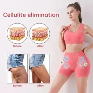 Paiduis™ Micro-Vibration Massage Module Ice Silk Ion Fiber Repair Shaping Shorts