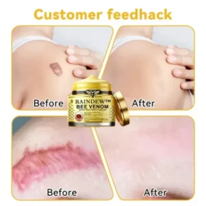 Raindew™ Bee Venom Skin Treatment Cream