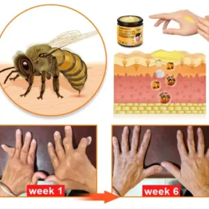 Raindew™ Bee Venom & Turmeric Joint and Bone Pain Relief Cream