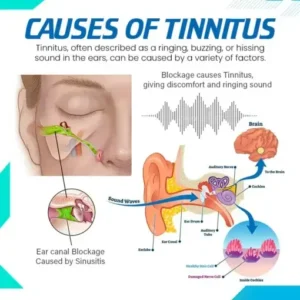 Tinnseal™ Goldenseal Ear Drop